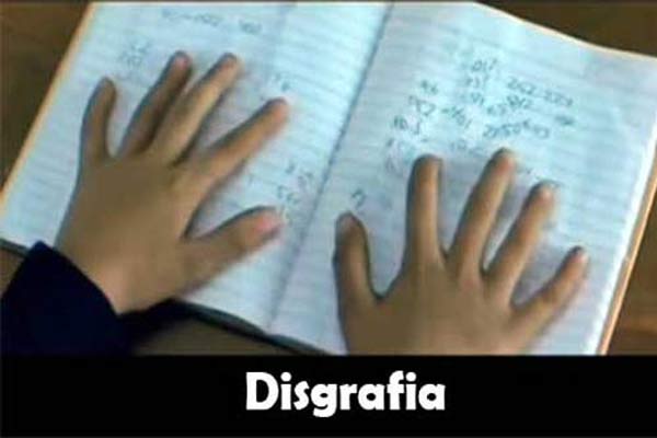 Pengertian Disgrafia